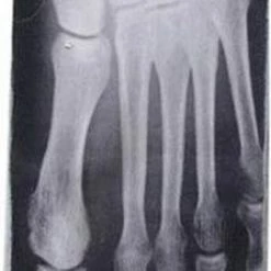 Hete verkoop ✔️ Merkloos 3-D Funsok Skeletvoet / Rontgenvoet 🔥